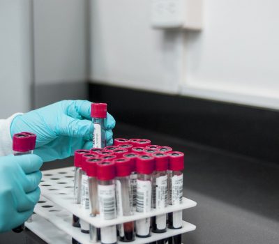 badania laboratoryjne poznań